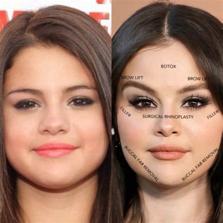 Did Xooos Get Plastic Surgery? Check Her Before and After Picture ·